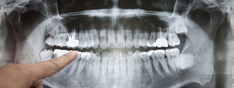 Proteção Radiológica Odontológica Proteção Radiológica Odontológica